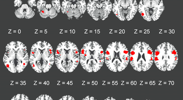 fMRI mirror neuron research